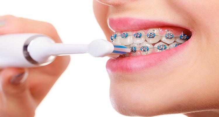 1088-best-electric-toothbrush-for-braces.jpg