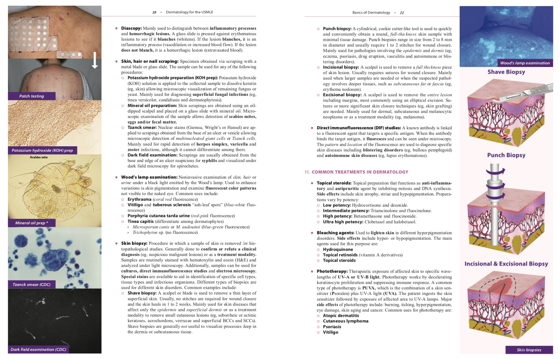 Chapter Samples - Dermatology for the USMLE