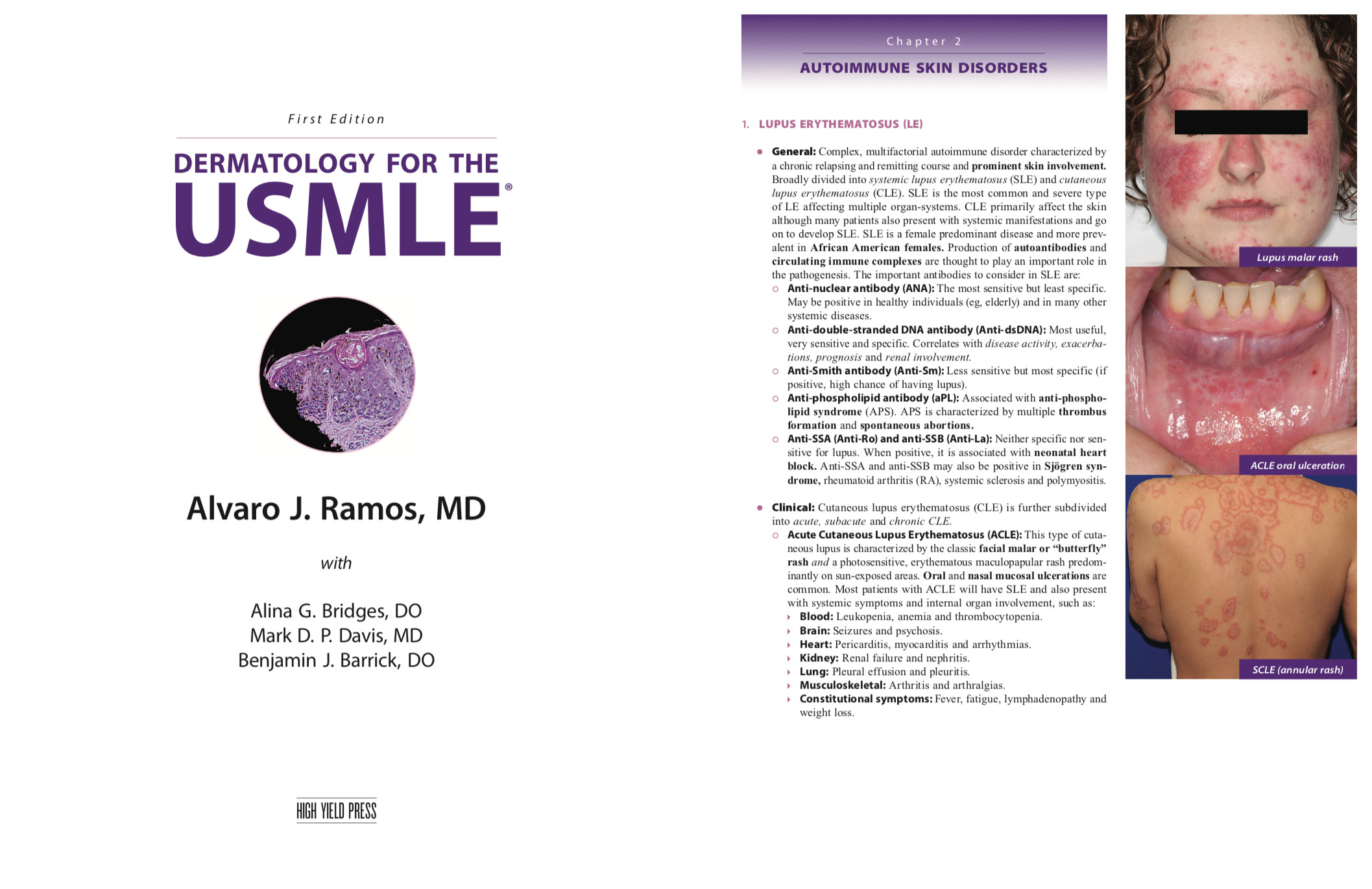 Chapter Samples - Dermatology for the USMLE