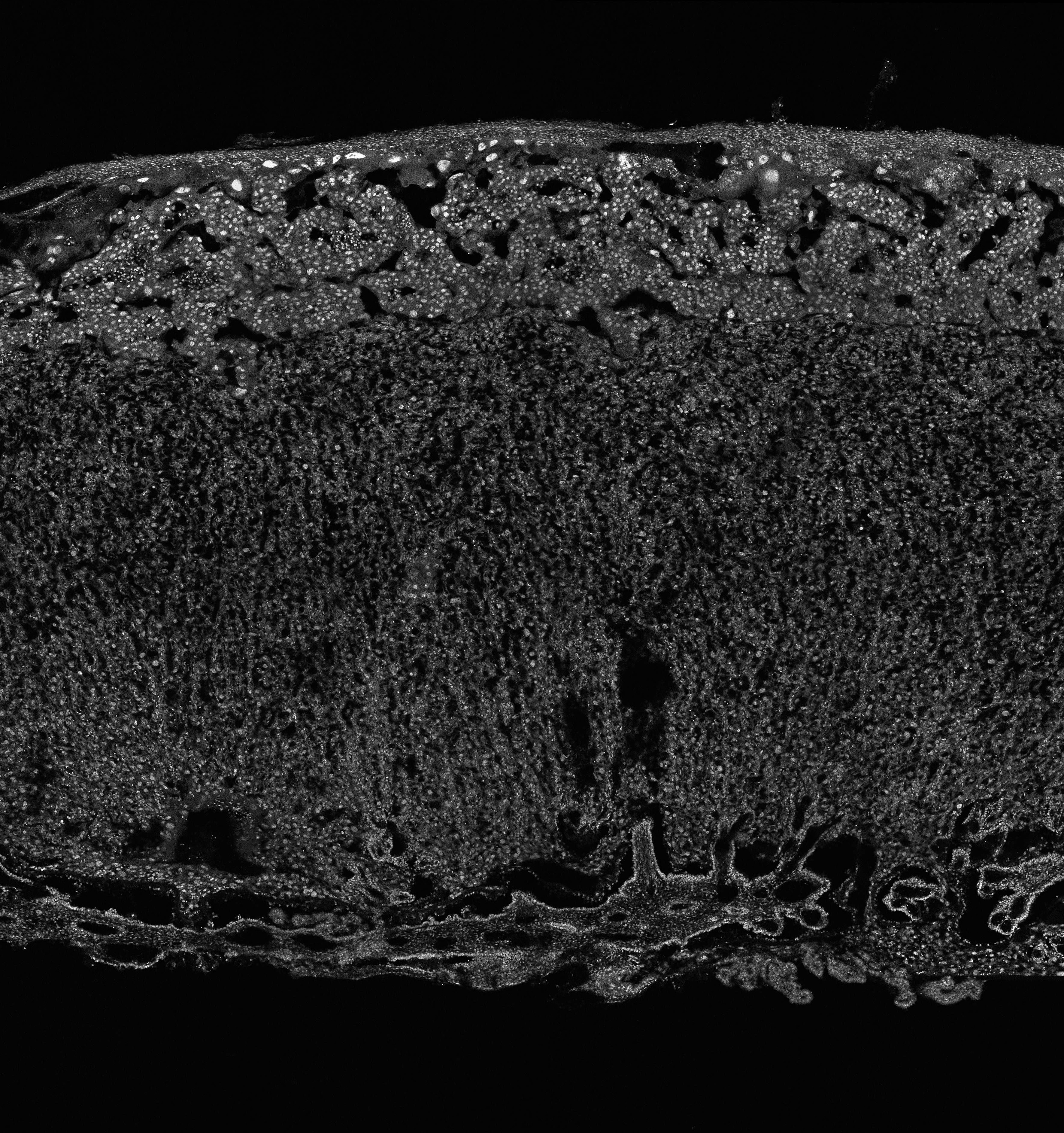 46873035433771159-3-e19-placenta-dapi-16250800163928.jpg