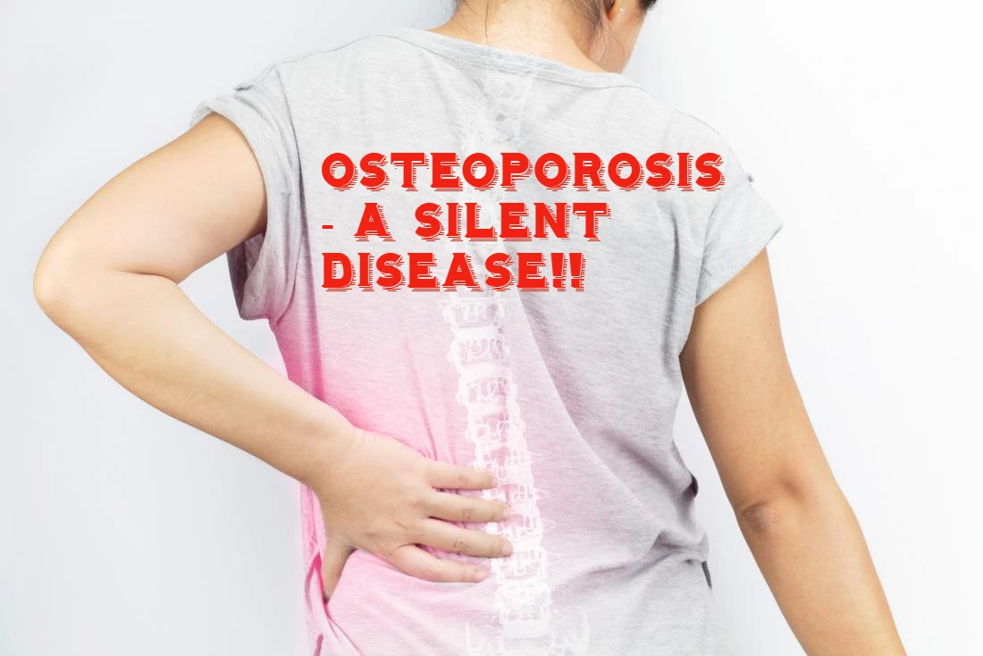 Osteoporosis 3541-0011007341857-osteoporosis.png