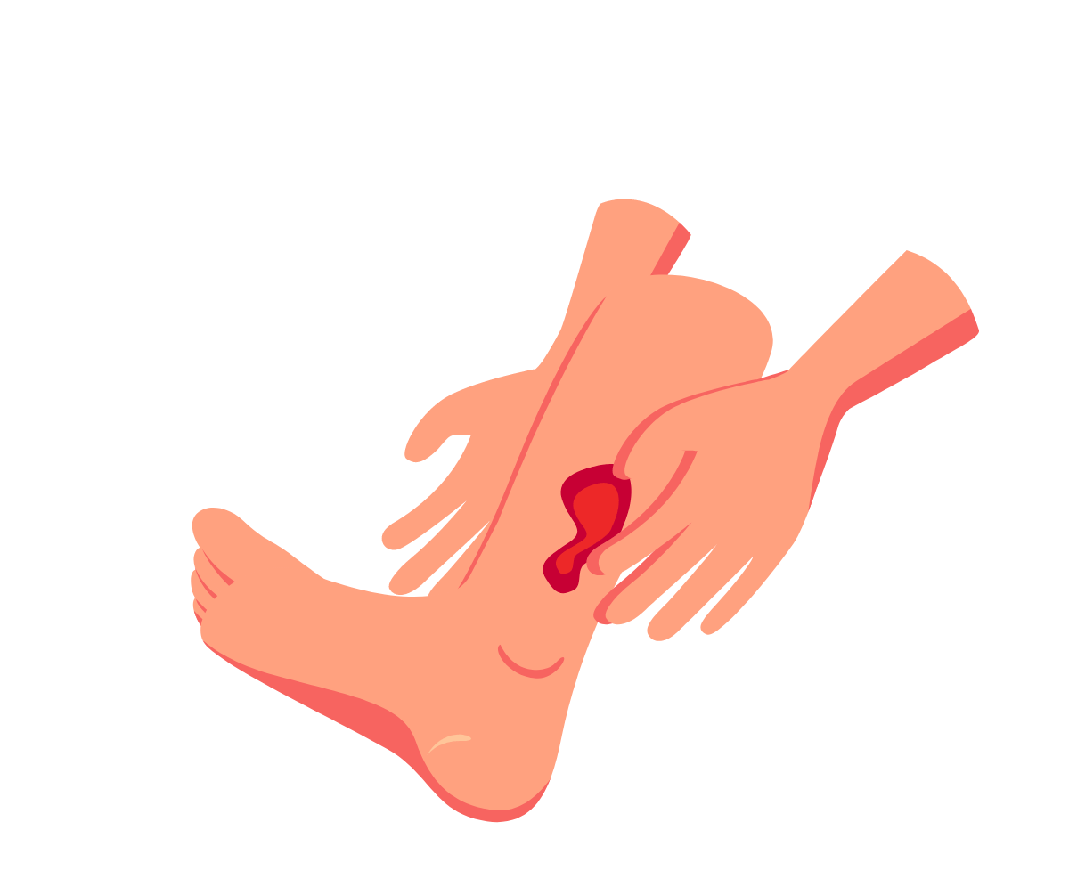 3039-wound.png