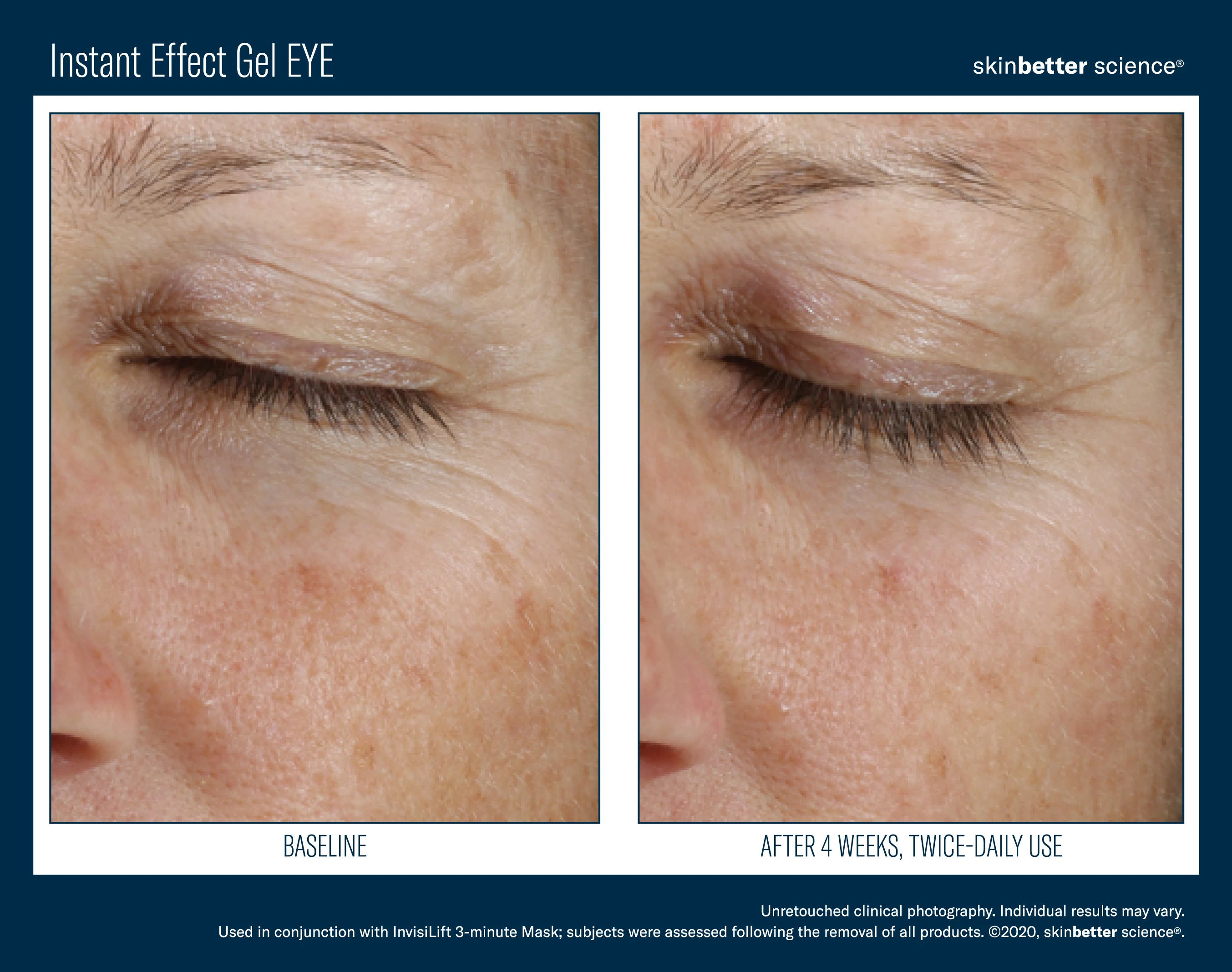 543-instant-effect-gel-eye-before-after-template2020hqp3-17187007277707.jpg