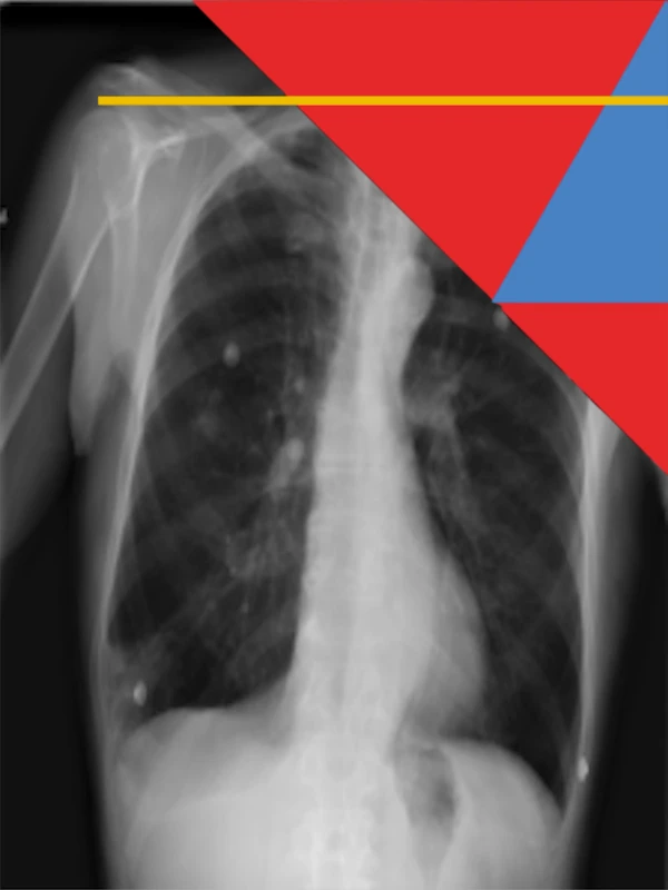 4512-mancepsradiology-17494961621918.png