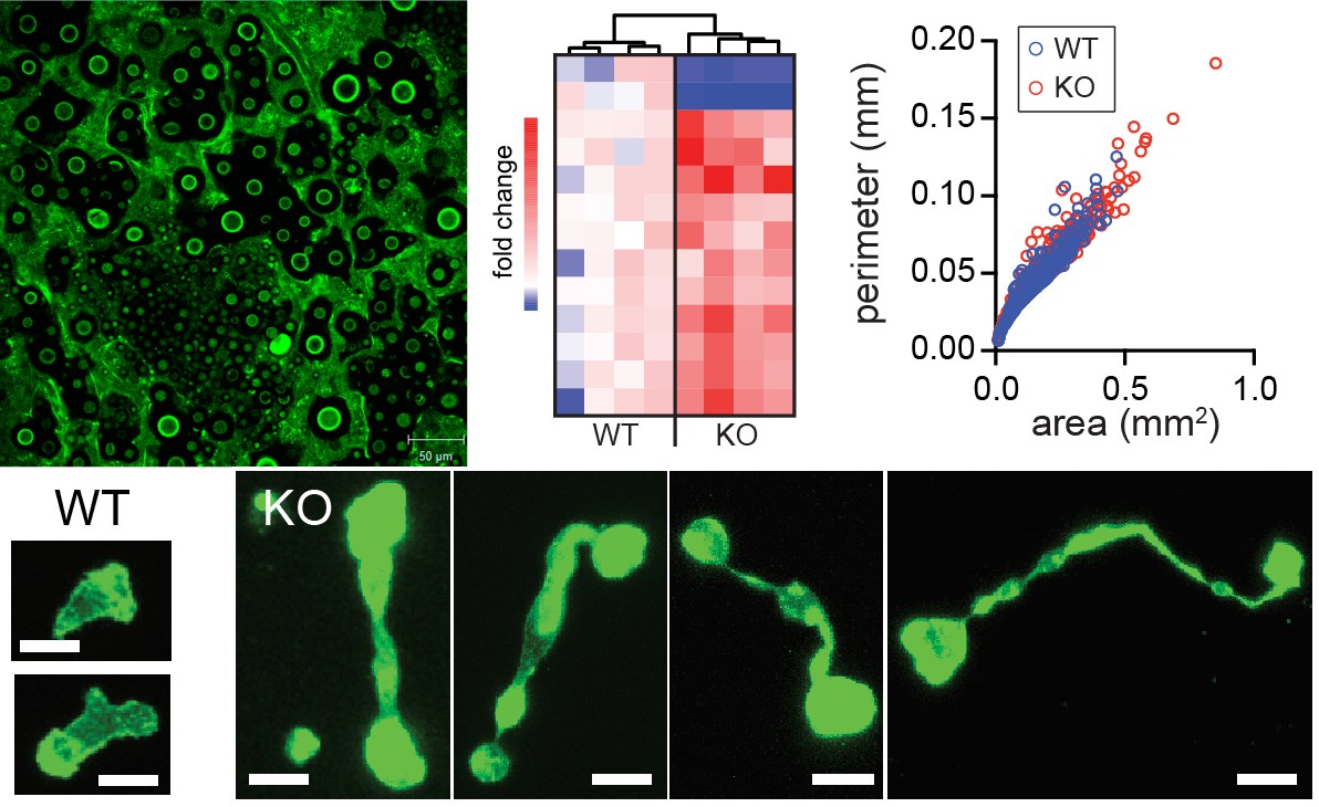 287-defects-in-immune-cell-migration.png