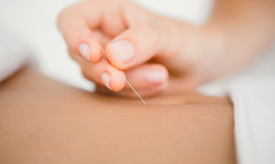 065900535516-acupuncture-2-2.jpeg