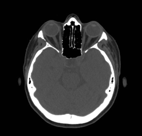 r19-brain-15988500170759.jpg