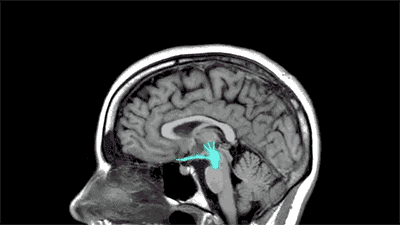 14-imgcr2.gif
