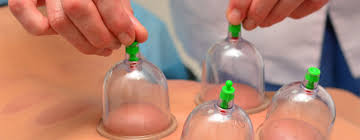 What is Cupping, Scraping and Moxibustion?